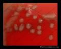 mucoid pneumococci, mucoid form of Streptococcus pneumoniae on blood agar